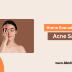 Top 10 Home Remedies For Acne Scars